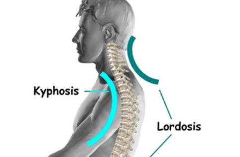 cervical lordosis images